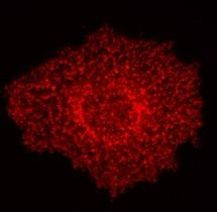 Eps15 Antibody in Immunocytochemistry (ICC/IF)