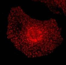 EPS15 Antibody in Immunocytochemistry (ICC/IF)