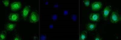 TRPM2 Antibody in Immunocytochemistry (ICC/IF)