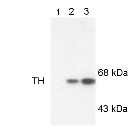 Phospho-Tyrosine Hydroxylase (Ser19) Antibody in Western Blot (WB)