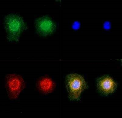TRPM2 Antibody in Immunocytochemistry (ICC/IF)