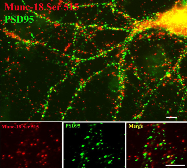 Phospho-MUNC18 (Ser515) Antibody in Immunocytochemistry (ICC/IF)