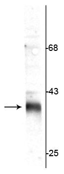 Stargazin Antibody in Western Blot (WB)