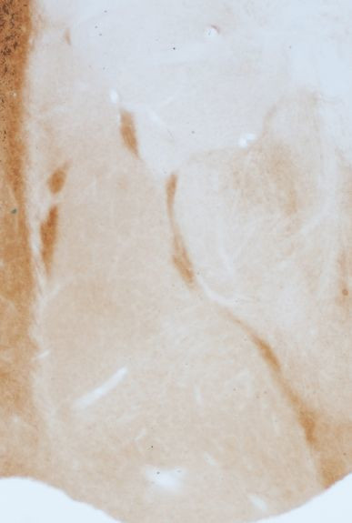 GABRA3 Antibody in Immunohistochemistry (IHC)