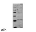 GCN5 Antibody in Western Blot (WB)