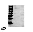 HIV1 Reverse Transcriptase Antibody in Western Blot (WB)
