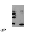 HIV1 p17 Antibody in Western Blot (WB)