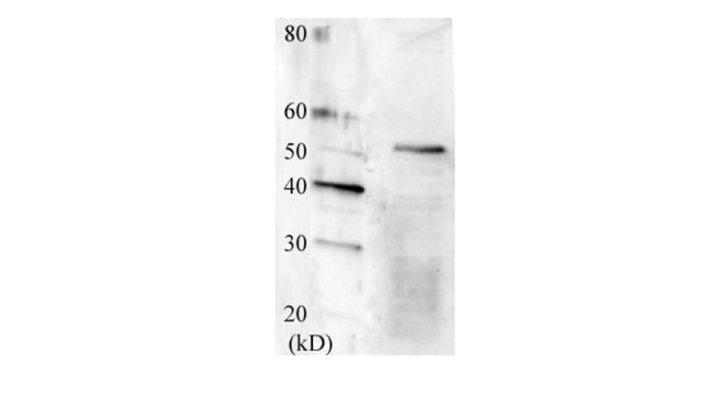 SWI6 Antibody in Western Blot (WB)