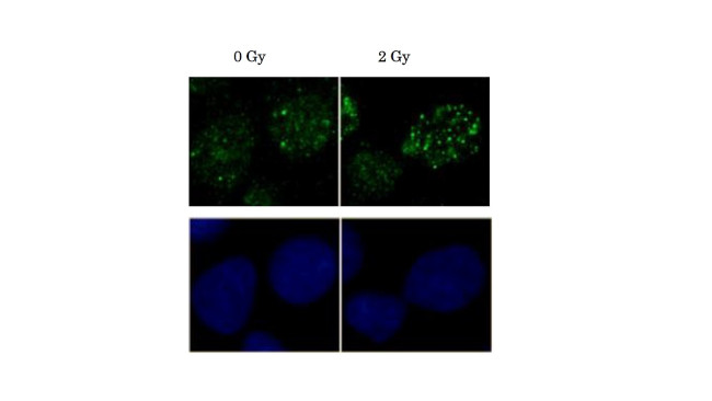 RAD51 Antibody in Immunocytochemistry (ICC/IF)