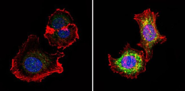 Phospho-p70 S6 Kinase (Thr389) Antibody in Immunocytochemistry (ICC/IF)