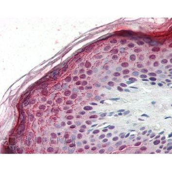 Aurora B Antibody in Immunohistochemistry (Paraffin) (IHC (P))
