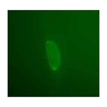 Emerin Antibody in Immunocytochemistry (ICC/IF)