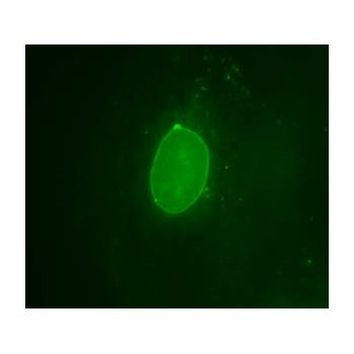 Emerin Antibody in Immunocytochemistry (ICC/IF)