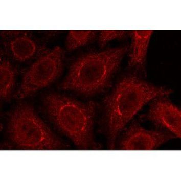 gp210 Antibody in Immunocytochemistry (ICC/IF)