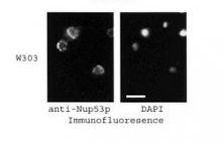 NUP53 Antibody in Immunocytochemistry (ICC/IF)