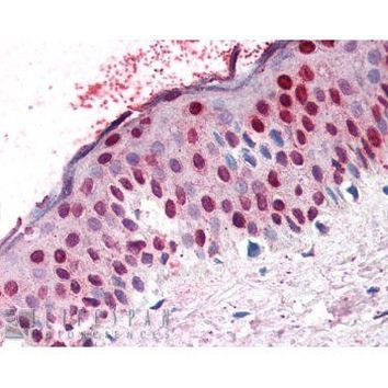 RANGAP1 Antibody in Immunohistochemistry (Paraffin) (IHC (P))