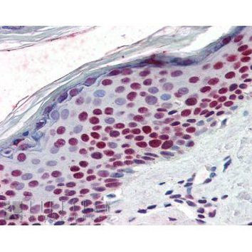 RCC1 Antibody in Immunohistochemistry (Paraffin) (IHC (P))