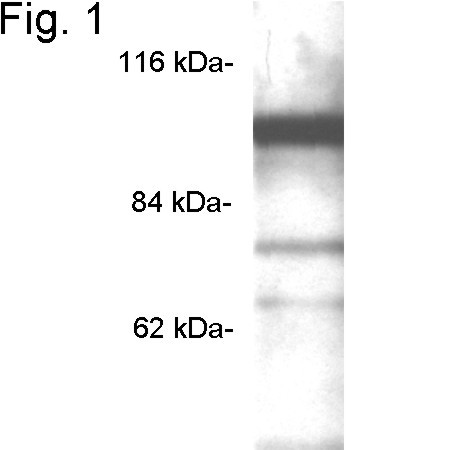 PDE6A Antibody in Western Blot (WB)
