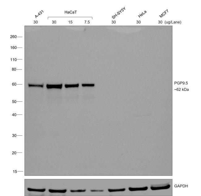 Mouse IgG1 Secondary Antibody in Western Blot (WB)