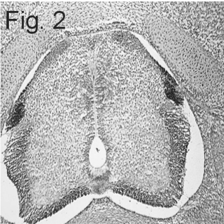 Cannabinoid Receptor 1 Antibody in Immunohistochemistry (IHC)