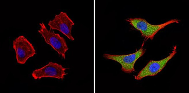 BACE2 Antibody in Immunocytochemistry (ICC/IF)
