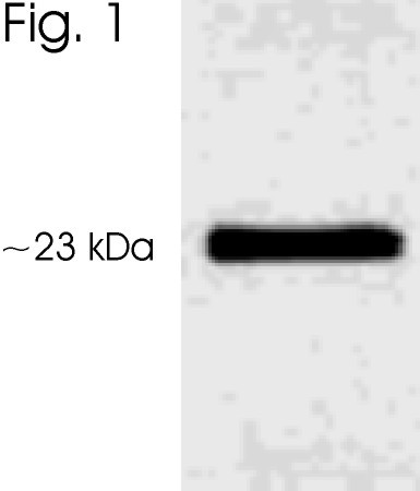 Phospho-AANAT (Ser206) Antibody in Western Blot (WB)