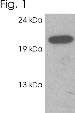 RAB3c Antibody in Western Blot (WB)
