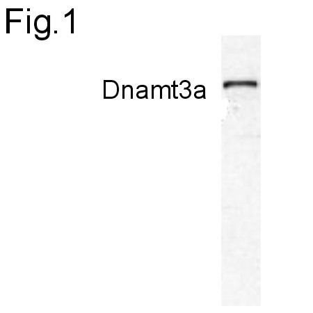 DNMT3A Antibody in Western Blot (WB)