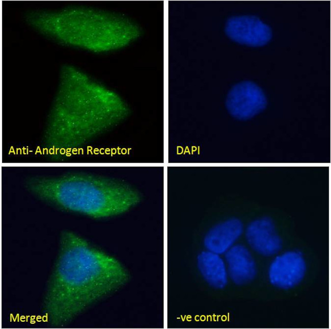 Androgen Receptor Antibody in Immunocytochemistry (ICC/IF)