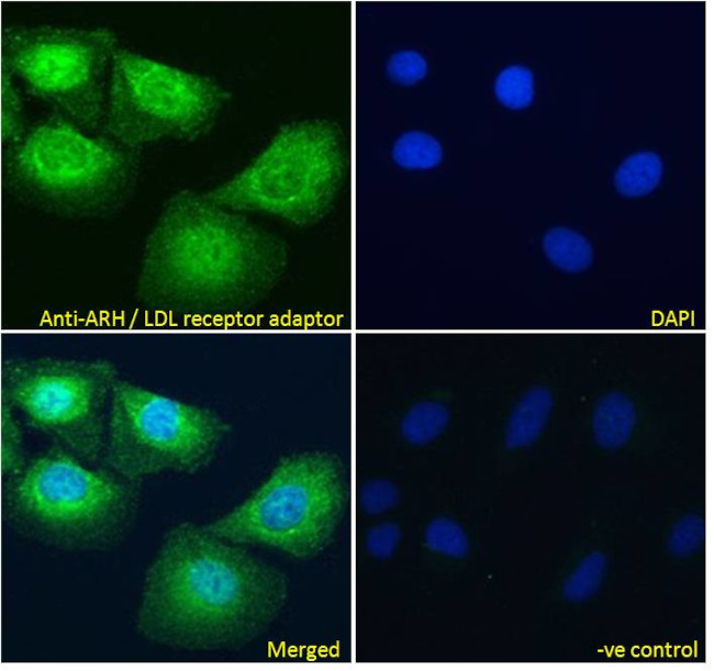 LDLRAP1 Antibody in Immunocytochemistry (ICC/IF)