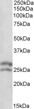 Bcl-2 Antibody in Western Blot (WB)