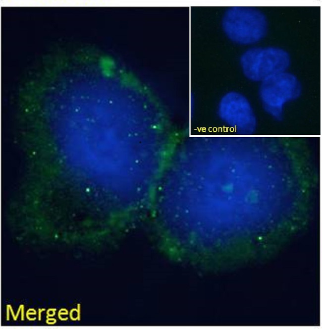 BLNK Antibody in Immunocytochemistry (ICC/IF)