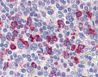 CD14 Antibody in Immunohistochemistry (Paraffin) (IHC (P))
