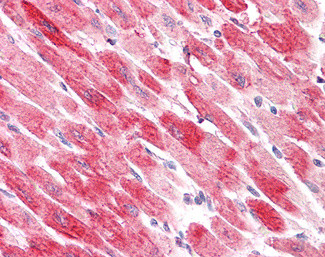 Cofilin 2 Antibody in Immunohistochemistry (Paraffin) (IHC (P))