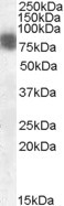 Cortactin Antibody in Western Blot (WB)