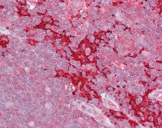 HPK1 Antibody in Immunohistochemistry (Paraffin) (IHC (P))