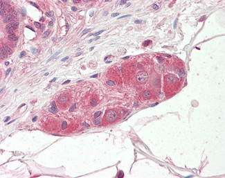 KLF8 Antibody in Immunohistochemistry (Paraffin) (IHC (P))