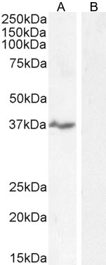 NKG2D Antibody in Western Blot (WB)