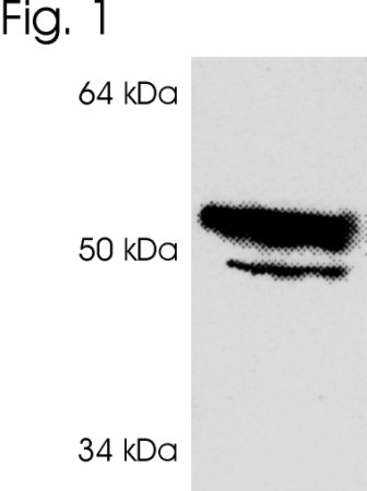 IP6K2 Antibody in Western Blot (WB)