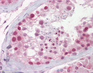 PES1 Antibody in Immunohistochemistry (Paraffin) (IHC (P))