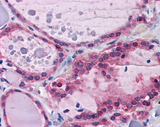 PPP2R1A Antibody in Immunohistochemistry (Paraffin) (IHC (P))