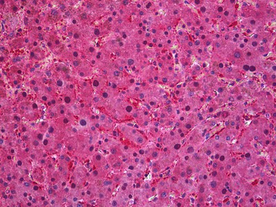 SEC61A1 Antibody in Immunohistochemistry (Paraffin) (IHC (P))