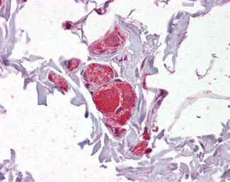 VAV2 Antibody in Immunohistochemistry (Paraffin) (IHC (P))