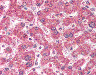 CMG1 Antibody in Immunohistochemistry (Paraffin) (IHC (P))