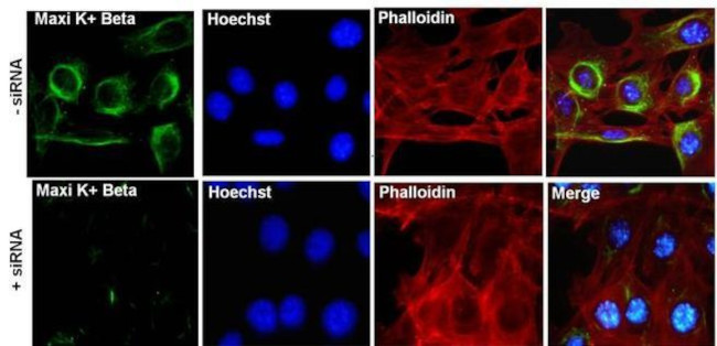 KCNMB1 Antibody in Immunocytochemistry (ICC/IF)