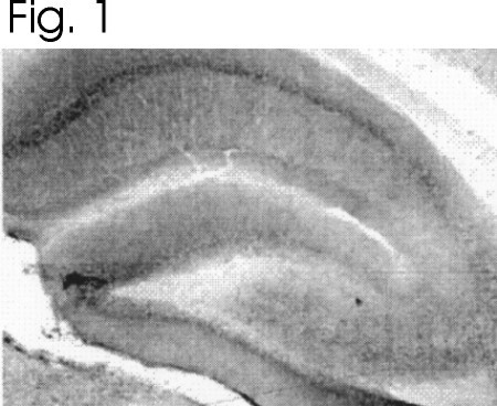 SLC24A2 Antibody in Immunohistochemistry (IHC)
