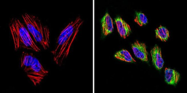 VDAC3 Antibody in Immunocytochemistry (ICC/IF)