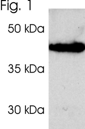 PSMD2 Antibody in Western Blot (WB)
