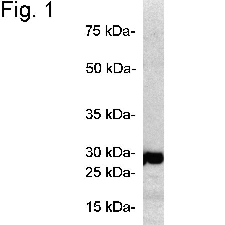 PSMB7 Antibody in Western Blot (WB)