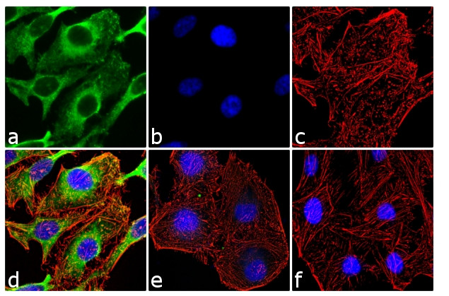 Phospho-HSP27 (Ser85) Antibody in Immunocytochemistry (ICC/IF)